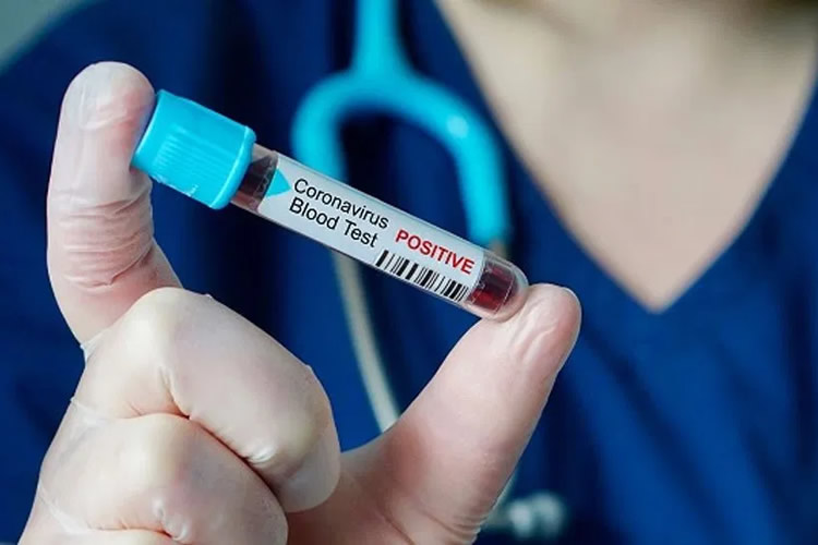法国医护检测新冠血液样品